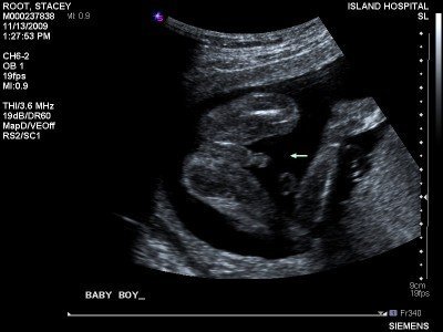 It's a boy, and what a boy!