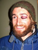 So this old guy walked up and punched me in the eye... So this old guy walked up and punched me in the eye...